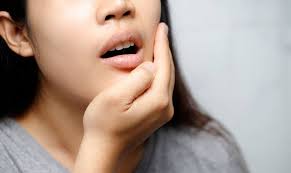 Răng bọc sứ hay giắt thức ăn: Cần kiểm tra kẽ răng hay viền mão sứ?
