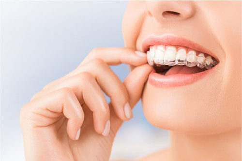 Răng sứ bị mẻ một góc: Có thể sửa hay phải làm lại mão sứ?