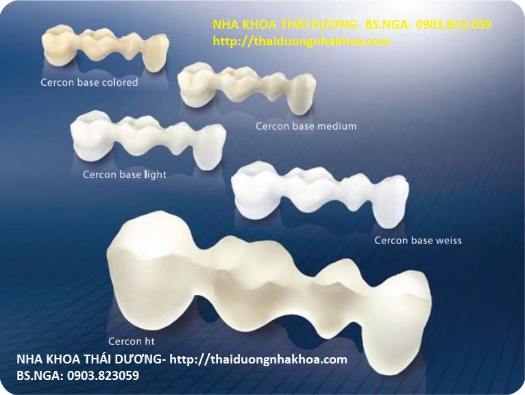 Răng Sứ Cercon Giá Bao Nhiêu