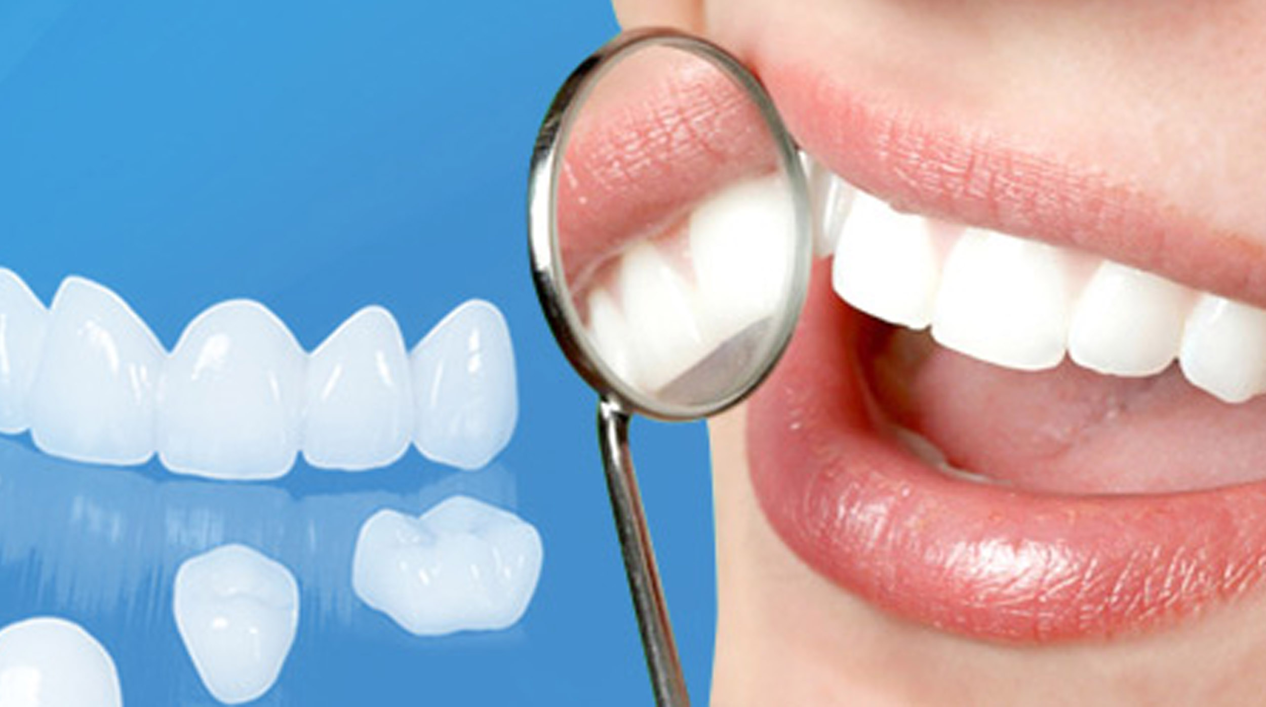 Hướng Dẫn Vệ Sinh Răng Miệng Sau Khi Bọc Sứ Để Tăng Tuổi Thọ Răng