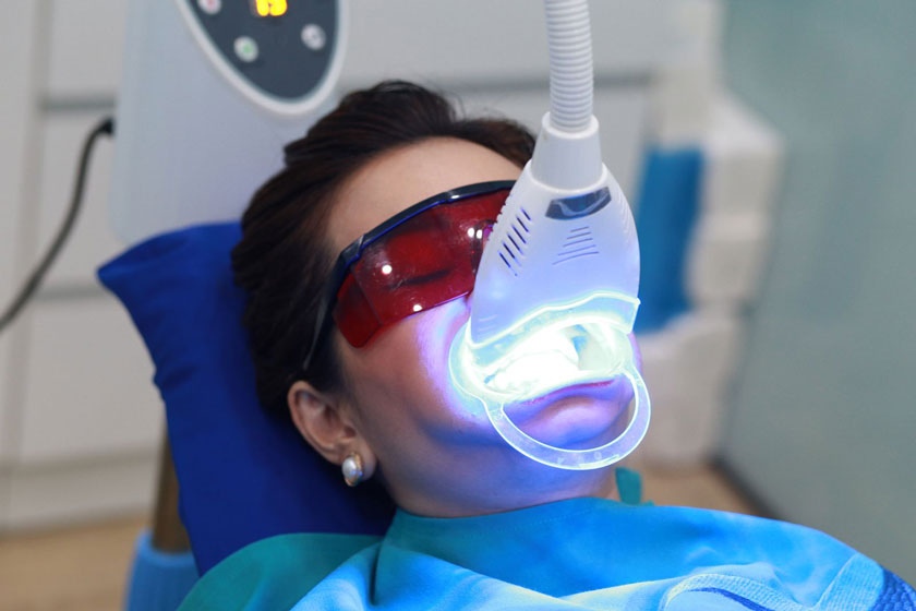 Tẩy Trắng Răng Plasma Có Tốt Không? Đánh Giá Từ Chuyên Gia Nha Khoa