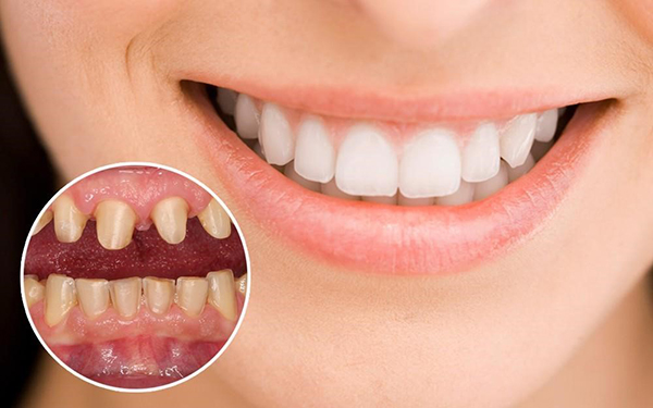 Nha Khoa Thái Dương: Địa Chỉ Làm Răng Sứ Uy Tín, Cho Nụ Cười Đẹp Tự Nhiên